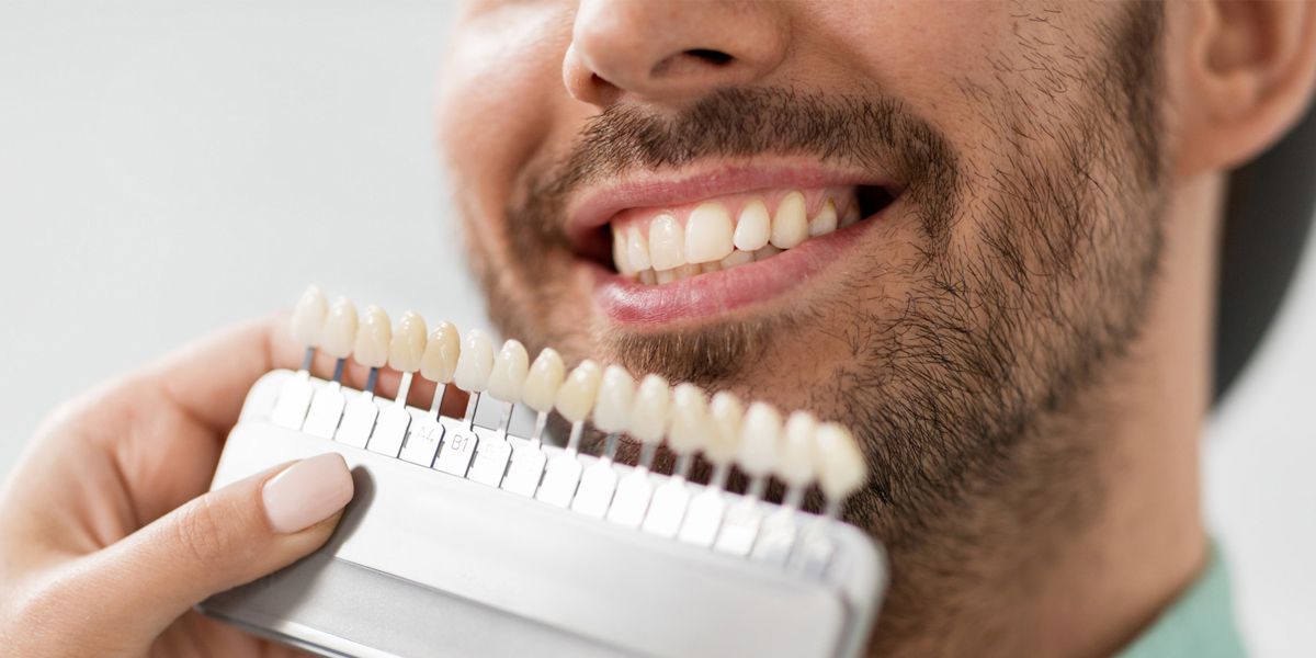 Types of Dental Veneers, Their Installation Procedures, and Aftercare Tips